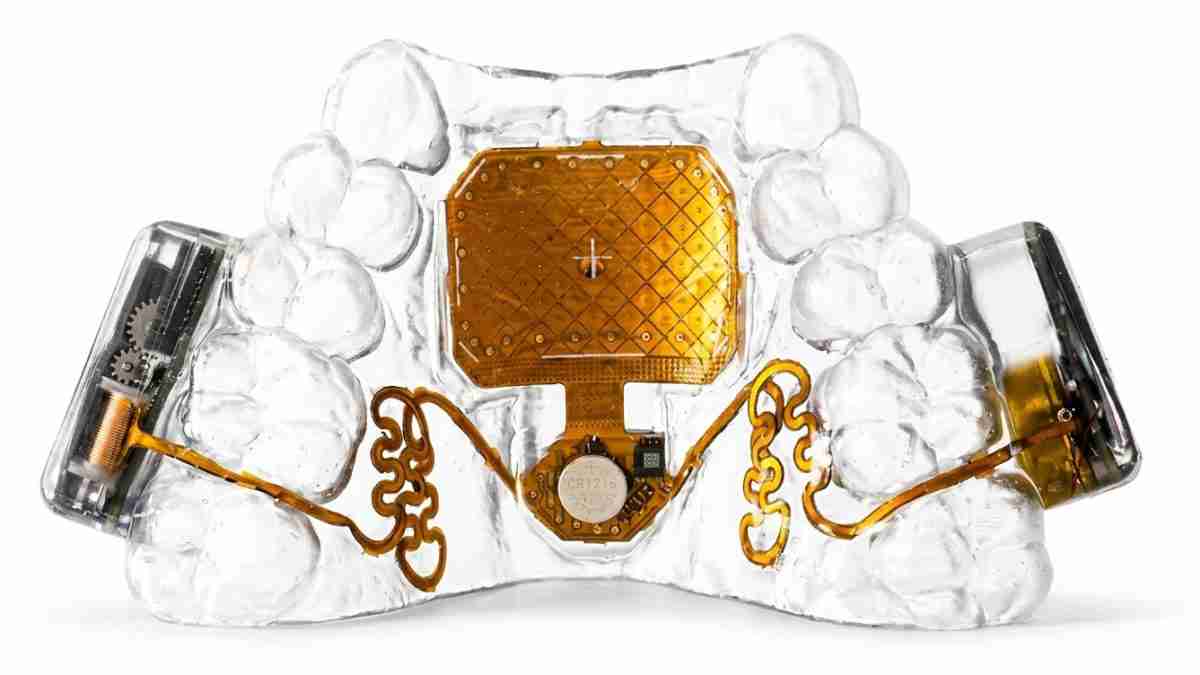 Clear dental model showing a gold-plated implant in the center with surrounding wiring for a dental prosthetic